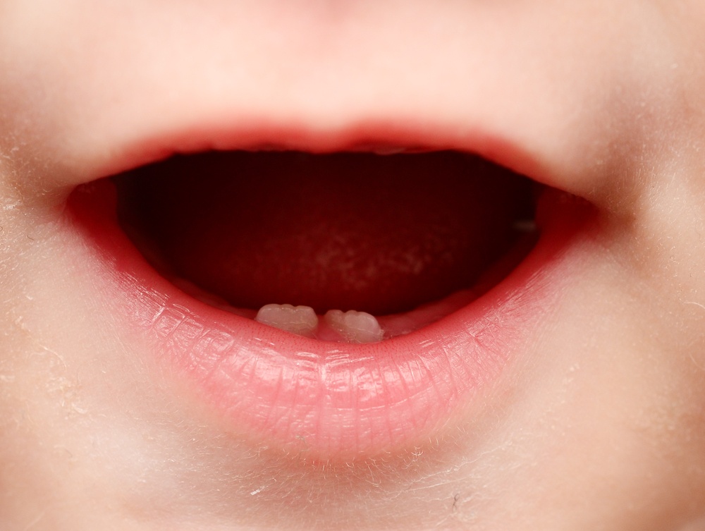 Les Dents Definitives De Mon Enfant Poussent Derriere Ses Dents De Lait Que Faire Top Produits Bebe